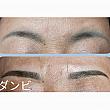 自然眉毛
長く持つために濃い目の色を使いました。
既存の色が濃く残っている場合は色を薄く中化すると希望の色になりやすいです。