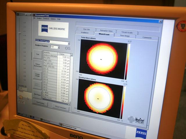 検査の結果はこの画面で確認されます