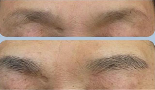 男性眉施術前（上）<br>男性眉施術後（下）