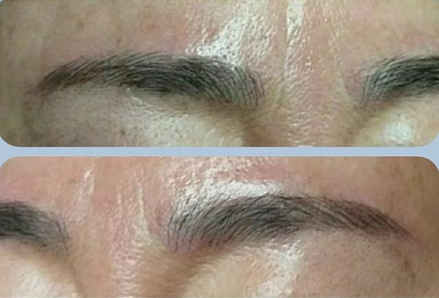 エンボ眉 施術例