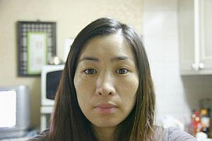 翌日<BR>色素が頬の辺りに浮き上がって、少し表皮がつっぱった感じ。