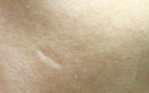 1週間後<BR>こんな感じ。