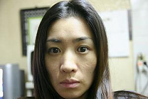 4日目<BR>どんどん薄皮が剥けます。