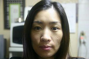 3日目<BR>角質が浮き出てきました。