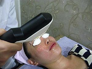 どのくらいの光なのかレーザー照射。