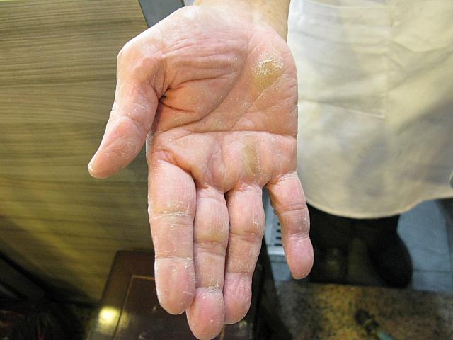 蔡さんの手です