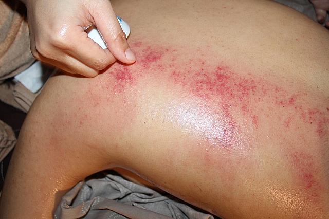 ナビのお友達はこんなに赤くなっていました！