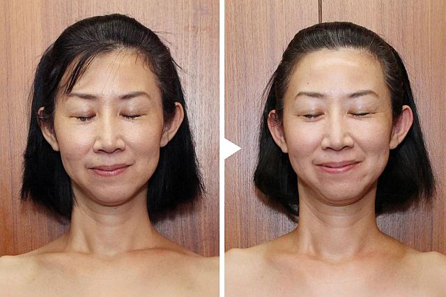 写真ではそこまでわからないかもしれませんが、鼻がすぅ～と少し立体的になった気がしましたよ～♪