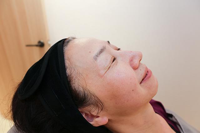 施術直後はまだ効いてない……